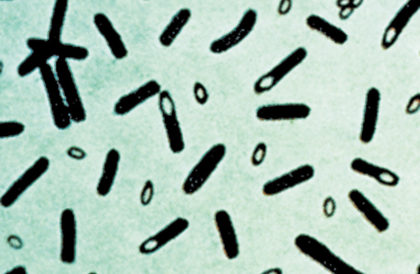 Анаэробные бактерии